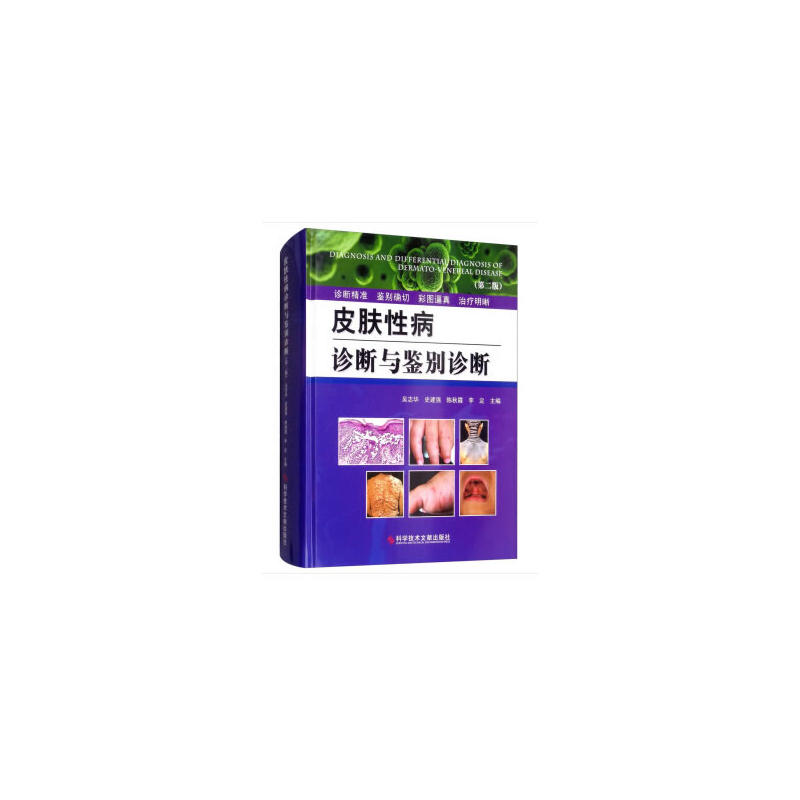 Ƥ�w�Բ��\���c�b�e�\�ࣨ�ڶ��棩