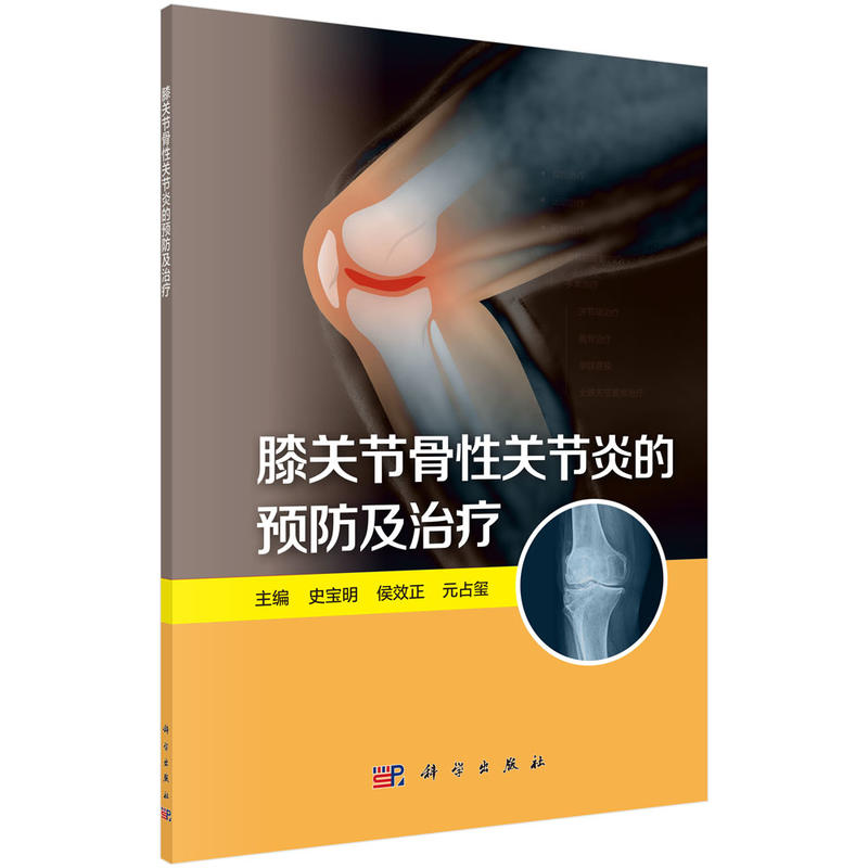 ϥ�P(gu��n)��(ji��)�����P(gu��n)��(ji��)�׵��A(y��)�����ί�