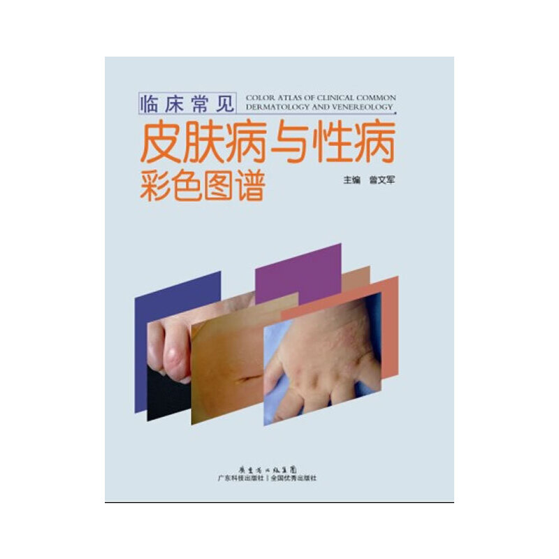 �R����Ҋ(ji��n)Ƥ�w���c�Բ���ɫ�D�V