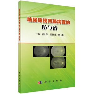 ����ҕ�W(w��ng)Ĥ��׃�ķ��c��