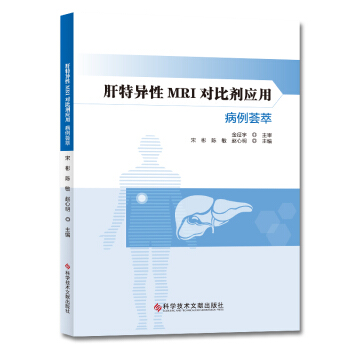 ���خ���MRI���Ȅ����ò����C��