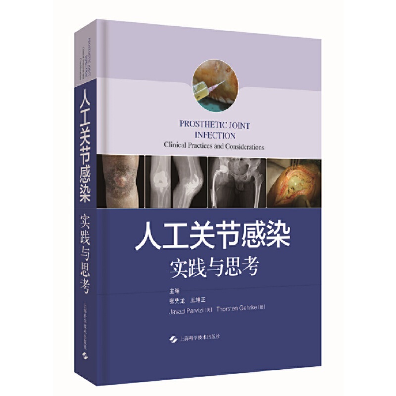 �˹��P(gu��n)��(ji��)��Ⱦ--��(sh��)�`�c˼��