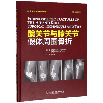 �y�P(gu��n)��(ji��)�cϥ�P(gu��n)��(ji��)���w�܇�����