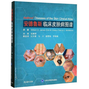 ������˹�R��Ƥ�w���D�V