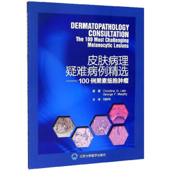 Ƥ�w�������y�������x��100�����ؼ�(x��)���[��