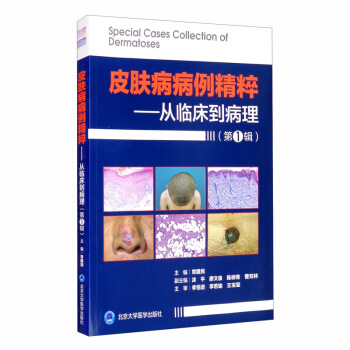 Ƥ�w���������⣺���R������������һ݋��