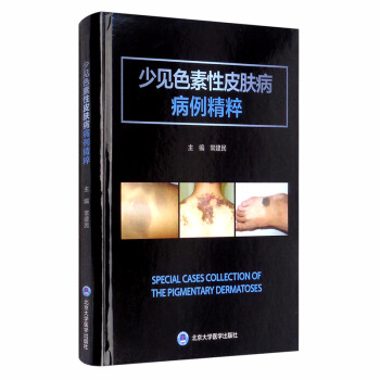 ��Ҋɫ����Ƥ�w����������