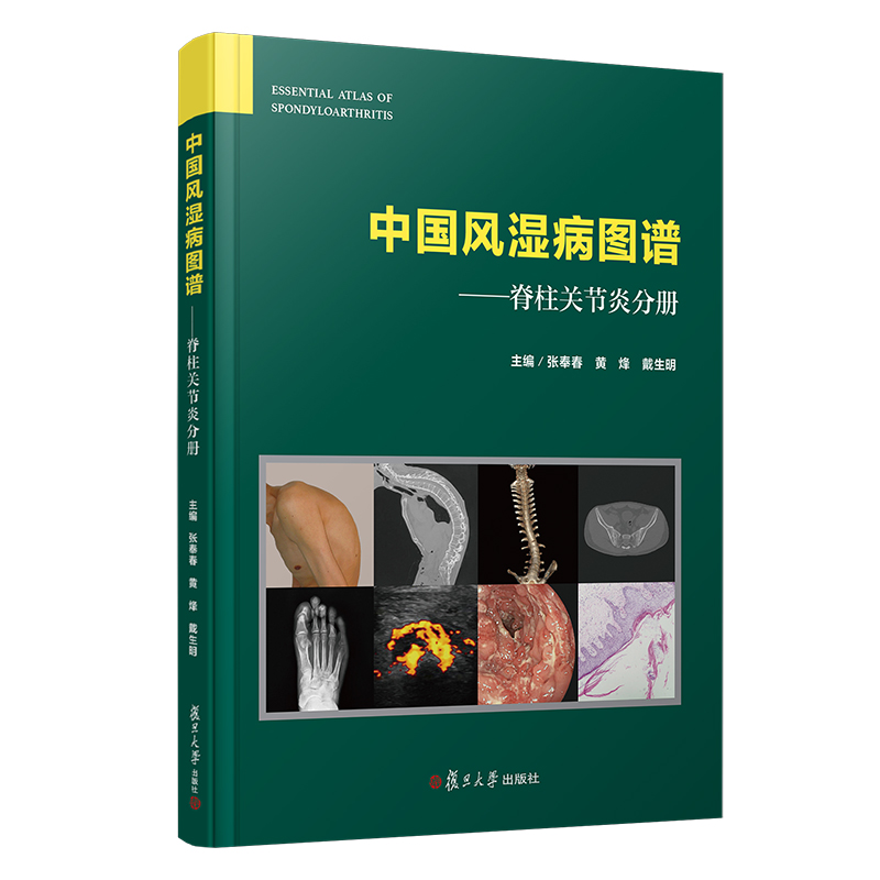 �Ї��L(f��ng)�񲡈D�V�������P(gu��n)��(ji��)�׷փԣ��Ї��L(f��ng)�񲡈D�V��