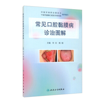 ��Ҋ��ǻ�Ĥ���\�ΈD��