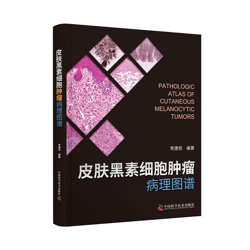 Ƥ�w���ؼ�(x��)���[������D�V