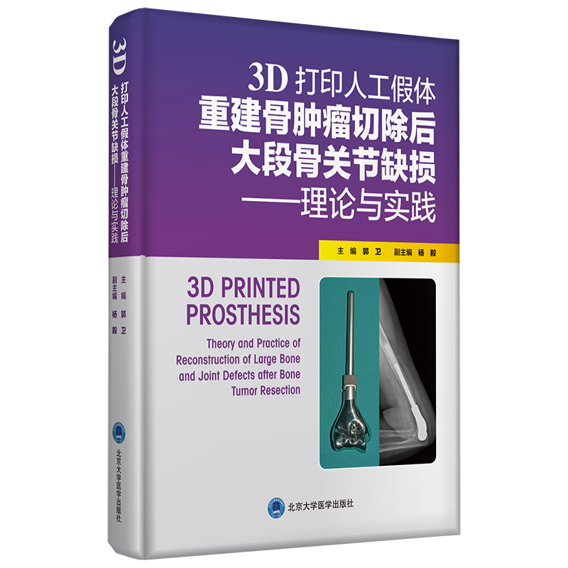 3D��ӡ�˹����w�ؽ����[���г����ι��P(gu��n)��(ji��)ȱ�p������Փ�c���`