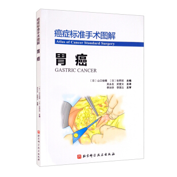 ���Y��(bi��o)��(zh��n)���g(sh��)�D�⣺θ��