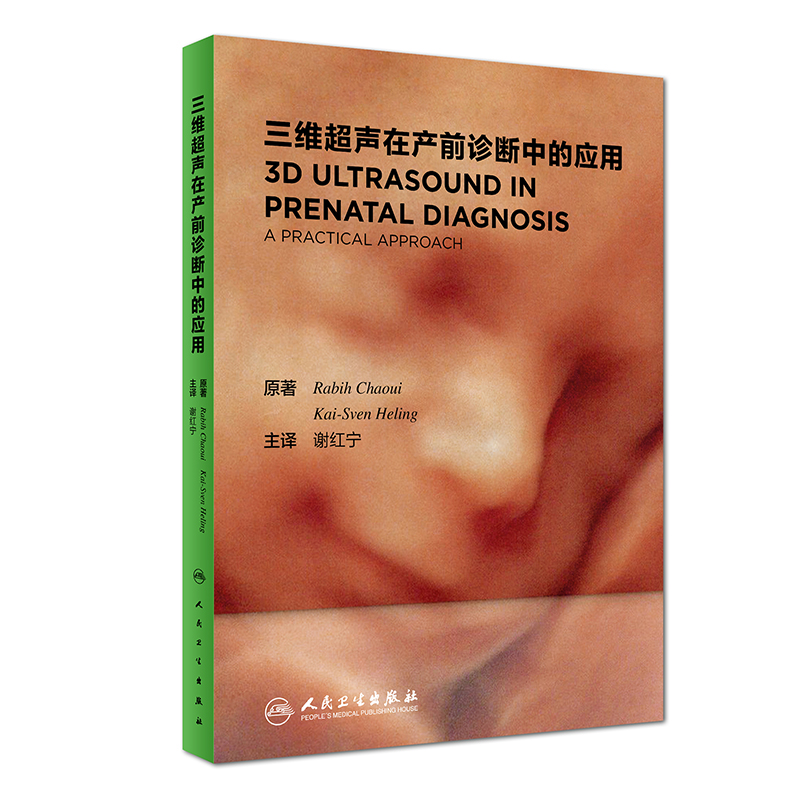 ���S���ڮa(ch��n)ǰ�\���еđ�(y��ng)�ã����g�棩