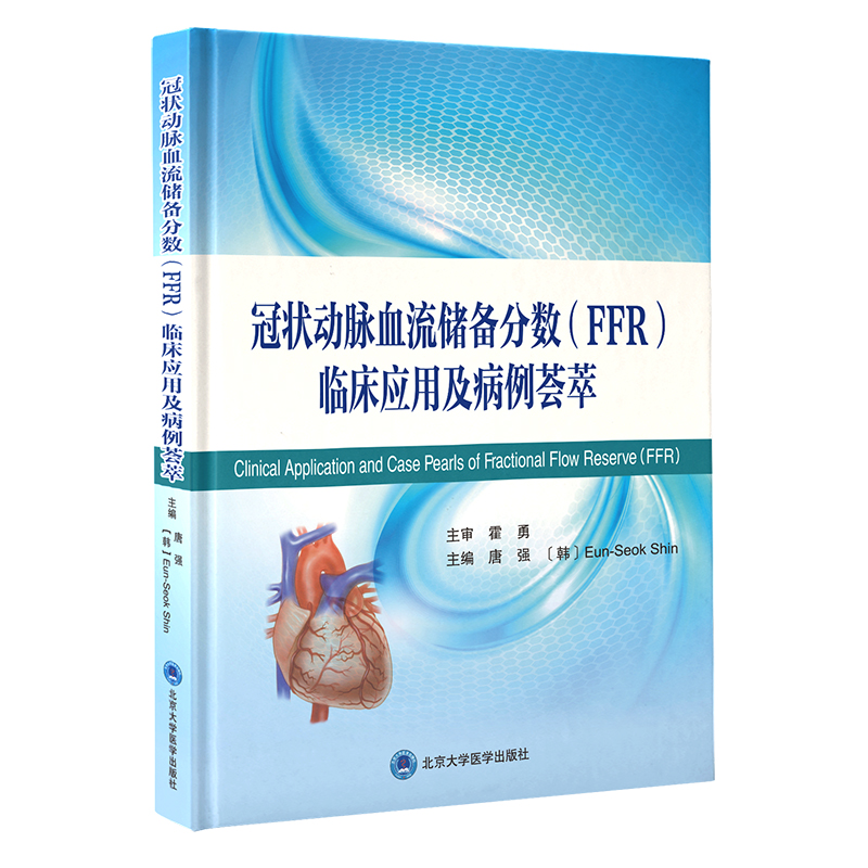 �ڠ���}Ѫ������֔�(sh��)��FFR���R�����ü������C��