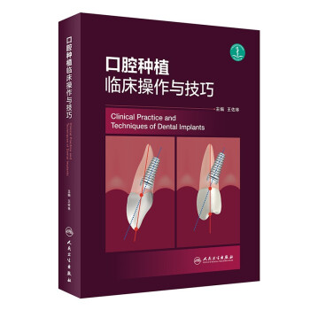 ��ǻ�Nֲ�R�������c����