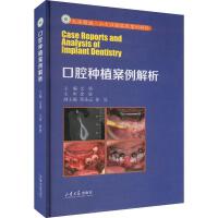 ��ǻ�Nֲ��������