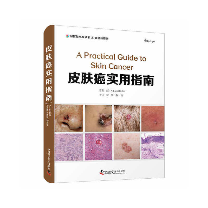 Ƥ�w������ָ��