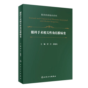 �ۿ����g(sh��)���P(gu��n)�ԽǽY(ji��)Ĥ��׃