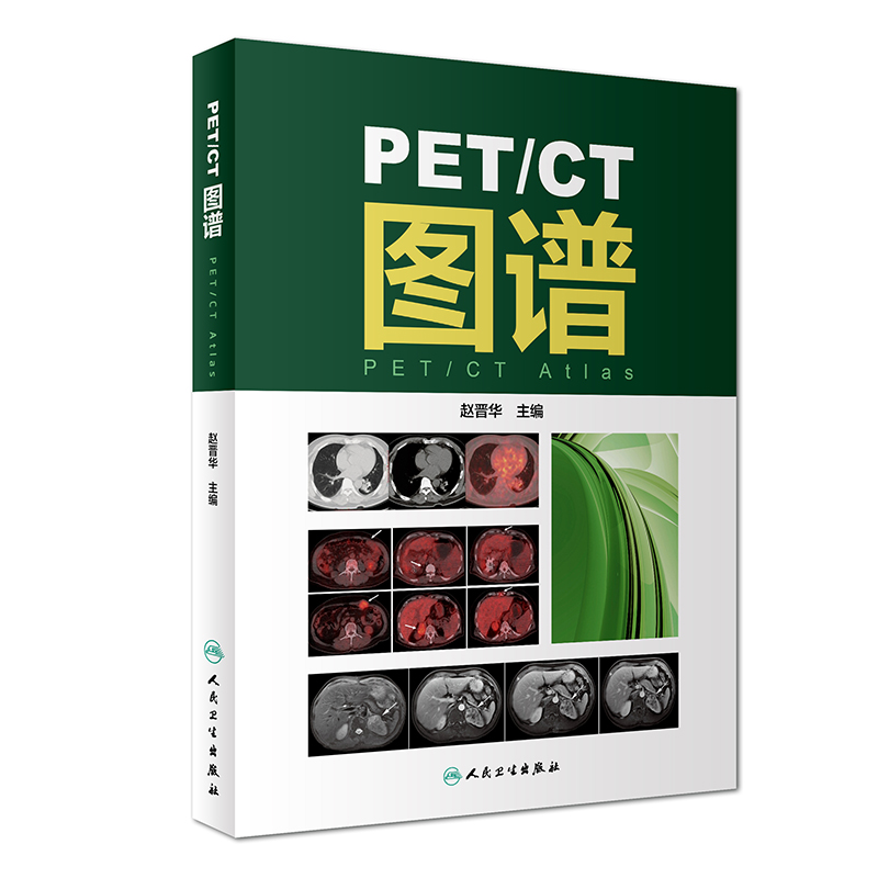 PET/CT�D�V