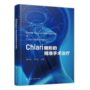 Chiari���εľ������g(sh��)�ί�