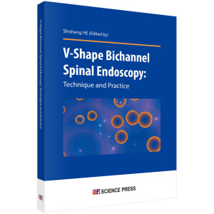 V���pͨ��������(n��i)�R���g(sh��)