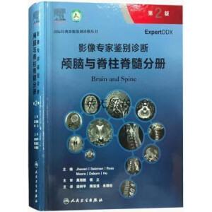 Ӱ�񌣼��b�e�\�ࡤ�B�X�c��������փԣ����g�棩