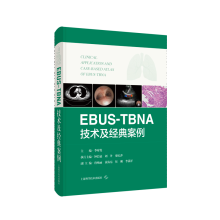 EBUS-TBNA���g(sh��)����(j��ng)�䰸��