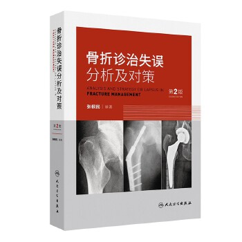 骨折診治失誤分析及對(duì)策