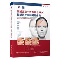 �D�⸻ѪС��Ѫ�{(PRP)΢��������݌�(sh��)��ָ��