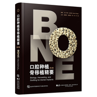 ��ǻ�Nֲ����ֲ��Ҫ