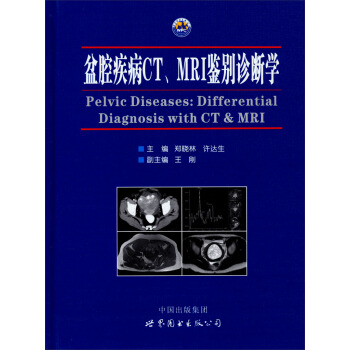 ��ǻ����CT��MRI�b�e�\���W(xu��)