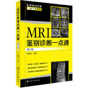 MRI�b�e�\��һ�c(di��n)ͨ