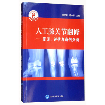 �˹�ϥ�P(gu��n)��(ji��)���ޣ�ԭ�����u���c��������