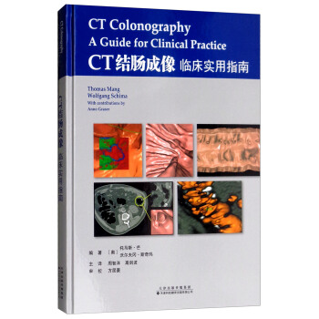 CT�Y(ji��)�c�����R����(sh��)��ָ��