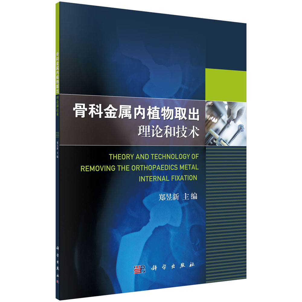 �ǿƽ��ك�ֲ��ȡ����Փ�ͼ��g