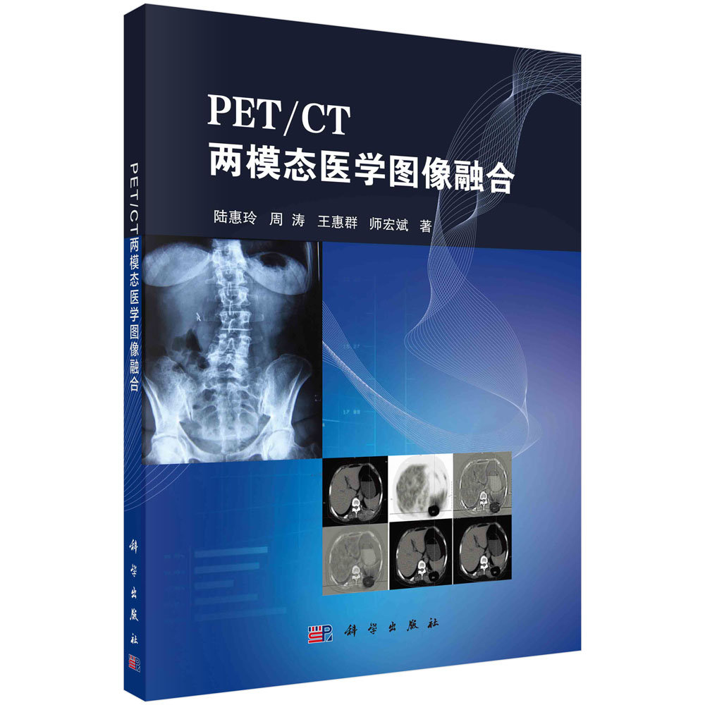 PET/CT��ģ�B(t��i)�t(y��)�W(xu��)�D���ں�