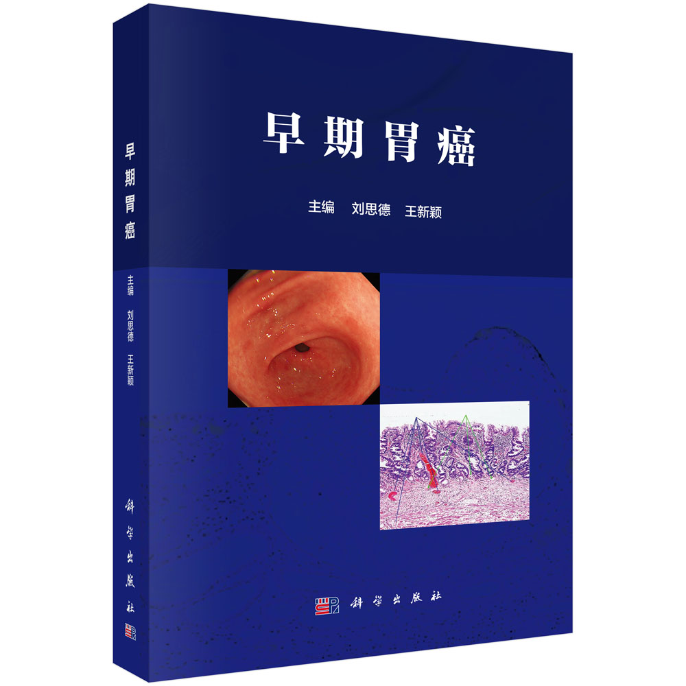 ����θ��