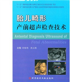 ̥�����ήa(ch��n)ǰ���z�鼼�g(sh��)