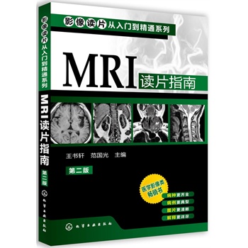 Ӱ���xƬ�����T����ͨϵ��--MRI�xƬָ��(�ڶ���)(�t(y��)�WӰ����N�������ٰ������N���Rȫ�����������ͣ��DƬ����������ጸ�Ԕ�M)