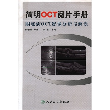 ����OCT�Ƭ�փ�