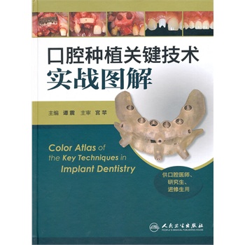 ��ǻ�Nֲ�P(gu��n)�I���g(sh��)����(zh��n)�D��