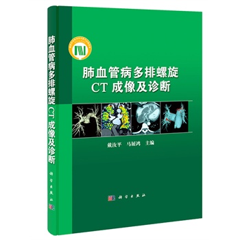 ��Ѫ�ܲ���������CT�����\��